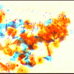 Εικόνα 6 στις 27.4.2010